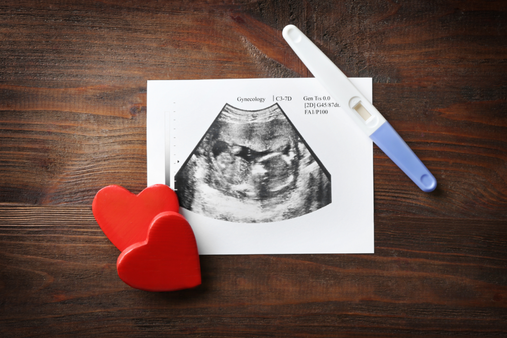 Ultrasound picture on a table with a pregnancy test and hearts