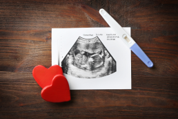 Ultrasound picture on a table with a pregnancy test and hearts